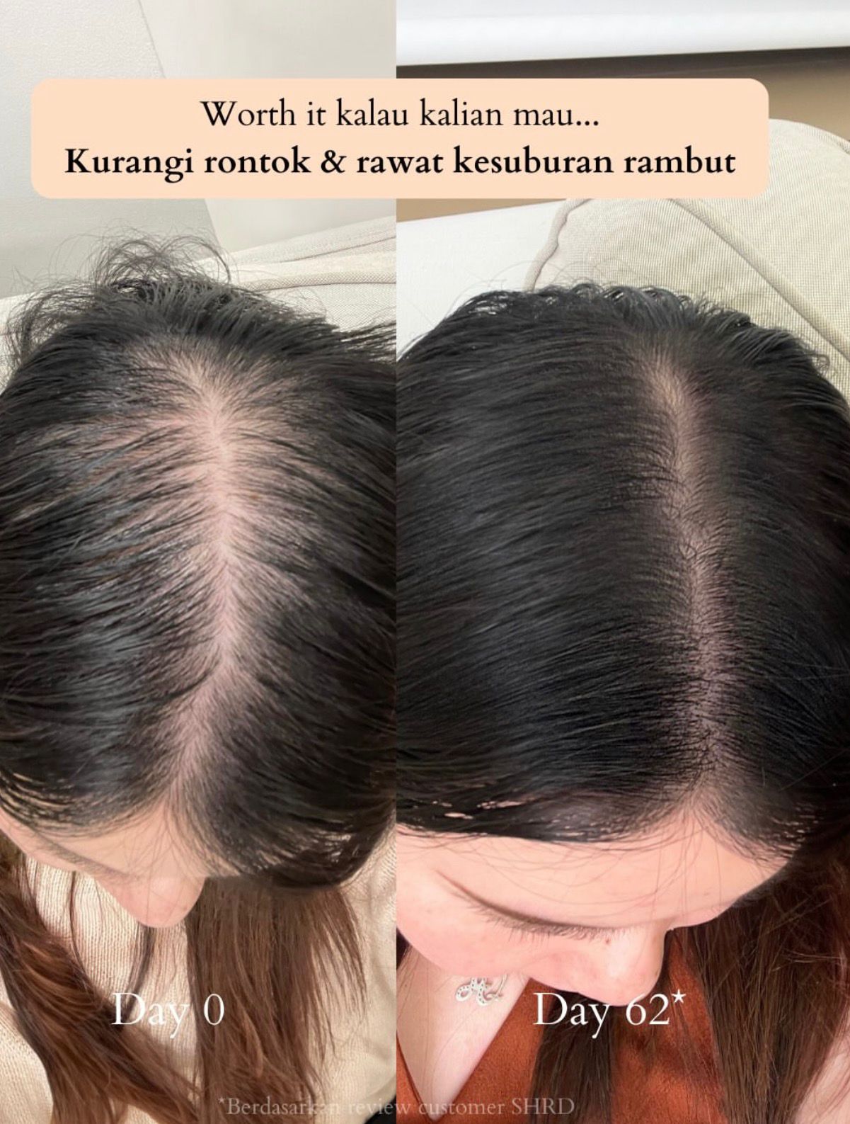 Original Mysore Karnataka ADIVASI HAKKI PIKKI HAIR OIL